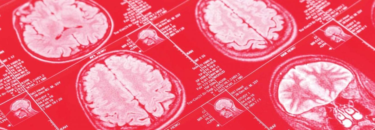 Apomorphine could help alcoholics. It's well documented that within a week it removes the physical craving for alcohol. A clinical trial is needed to prove if this is true.