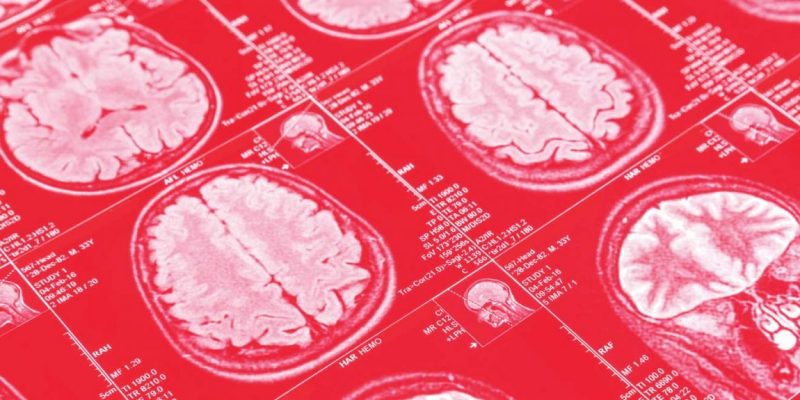 Apomorphine could help alcoholics. It's well documented that within a week it removes the physical craving for alcohol. A clinical trial is needed to prove if this is true.